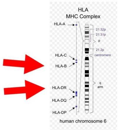 Wichtig bei Autoimmunerkrankungen ist das HLA-System auf dem sechsten Chromosom