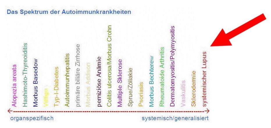 Das Spektrum der Autoimmunkrankheiten