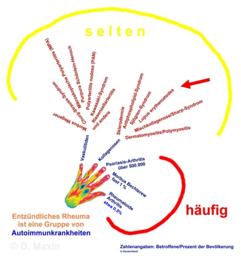 Die entzndlich-rheumatischen Erkrankungen